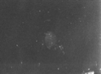 dental biolfilm